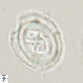 Chiasmolithus altus VR 34133