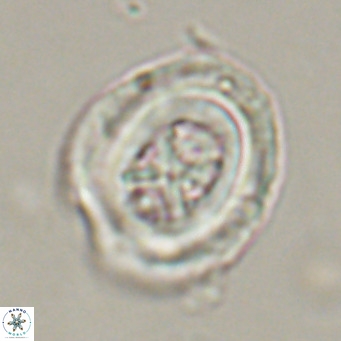 Chiasmolithus altus VR 34144