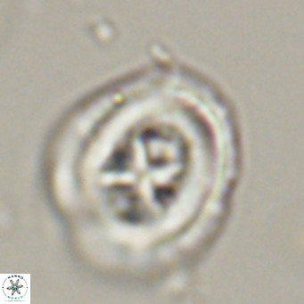 Chiasmolithus altus VR 34145