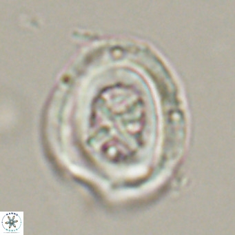 Chiasmolithus altus VR 34146