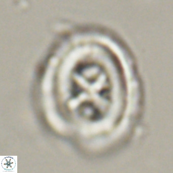 Chiasmolithus altus VR 34147
