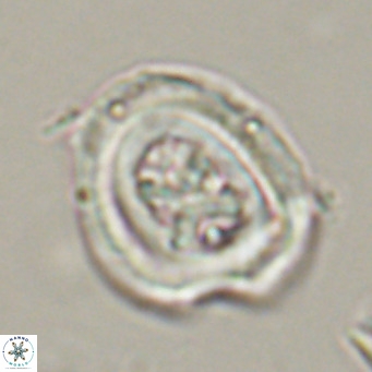Chiasmolithus altus VR 34148