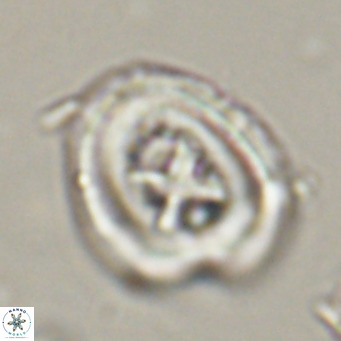 Chiasmolithus altus VR 34149
