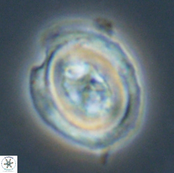 Chiasmolithus altus VR 34140