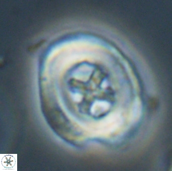 Chiasmolithus altus VR 34141