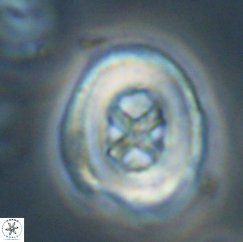 Chiasmolithus altus VR 34142