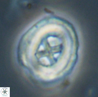 Chiasmolithus altus VR 34143