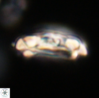 Chiasmolithus altus VR 34164
