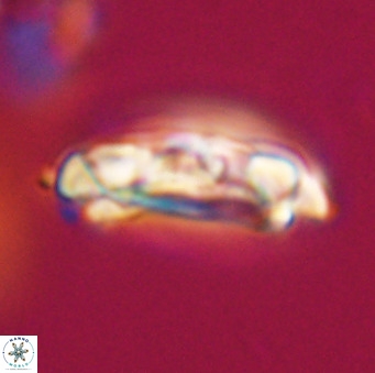 Chiasmolithus altus VR 34165