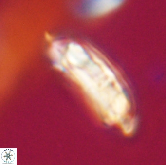 Chiasmolithus altus VR 34166
