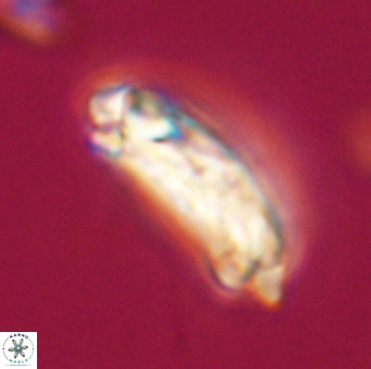 Chiasmolithus altus VR 34167