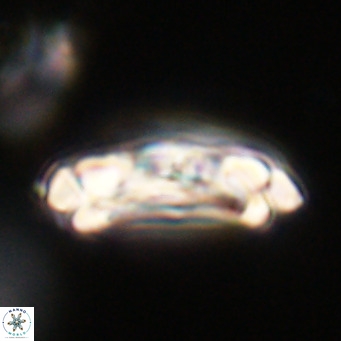 Chiasmolithus altus VR 34161