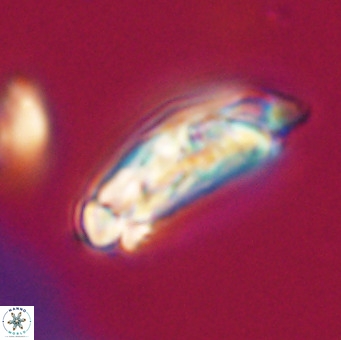 Chiasmolithus altus VR 34162