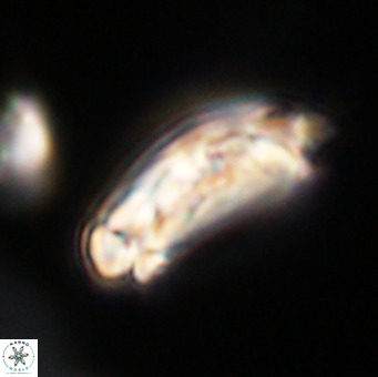 Chiasmolithus altus VR 34163