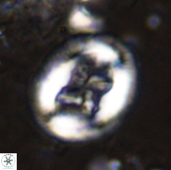 Chiasmolithus bidens 49032