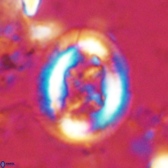 Chiasmolithus bidens 49034