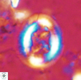 Chiasmolithus bidens 49034