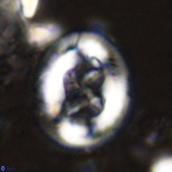 Chiasmolithus bidens 49035