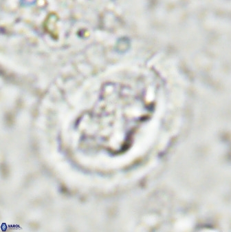 Chiasmolithus bidens 49038