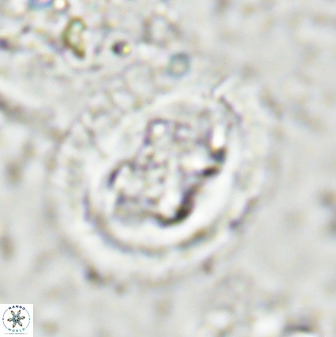 Chiasmolithus bidens 49038