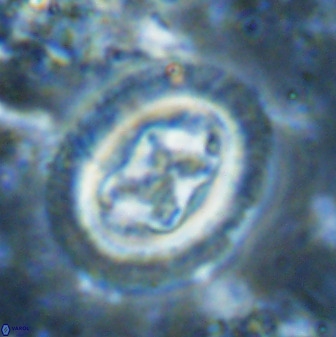 Chiasmolithus bidens 49039