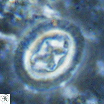 Chiasmolithus bidens 49039