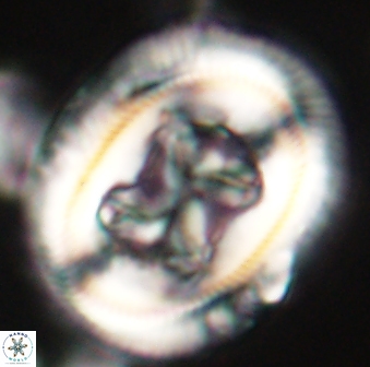 Chiasmolithus bidens 60898