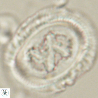 Chiasmolithus bidens 60899
