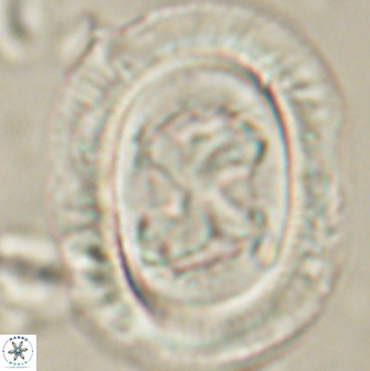 Chiasmolithus bidens 60901