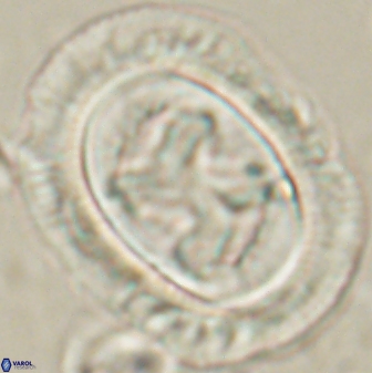 Chiasmolithus bidens 60902