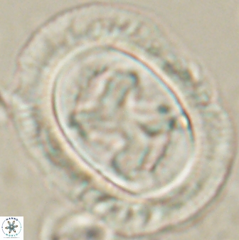 Chiasmolithus bidens 60902