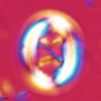 Chiasmolithus bidens 19927