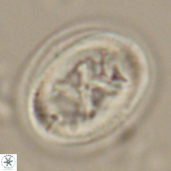 Chiasmolithus bidens 19931