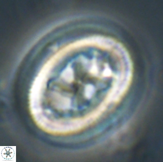 Chiasmolithus bidens 19932