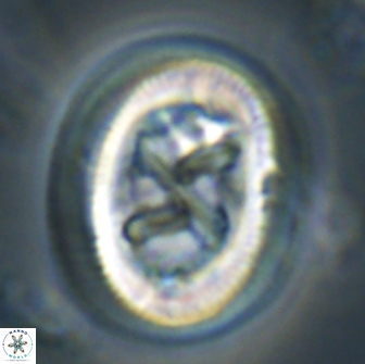 Chiasmolithus bidens 19933
