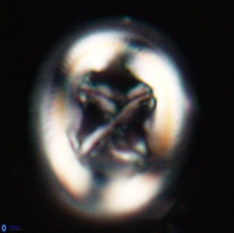 Chiasmolithus bidens 20157