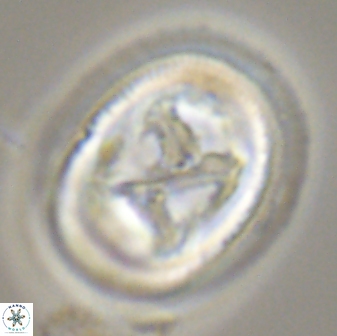 Chiasmolithus bidens 20161