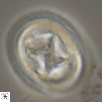 Chiasmolithus bidens 20163
