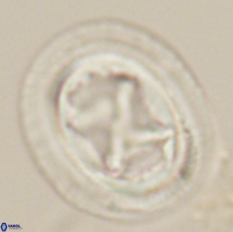 Chiasmolithus bidens 20164