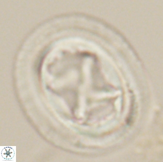 Chiasmolithus bidens 20164