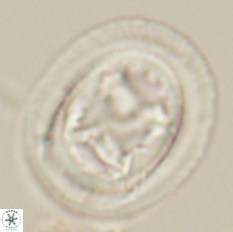 Chiasmolithus bidens 20166