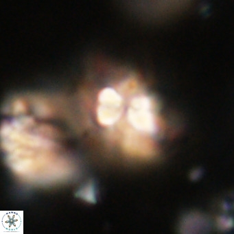 Chiasmolithus expansus VR 30716