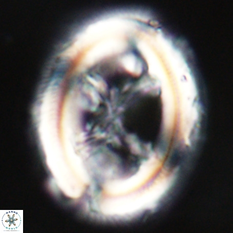 Chiasmolithus expansus VR 30726