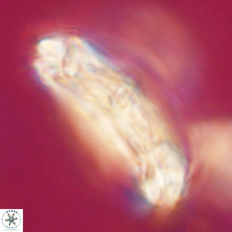 Chiasmolithus expansus VR 30721