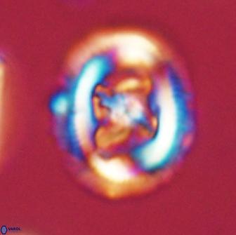 Chiasmolithus edentulus 66869