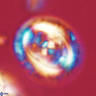 Chiasmolithus edentulus 66874