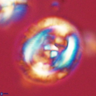 Chiasmolithus edentulus 66877