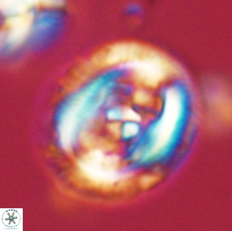Chiasmolithus edentulus 66877