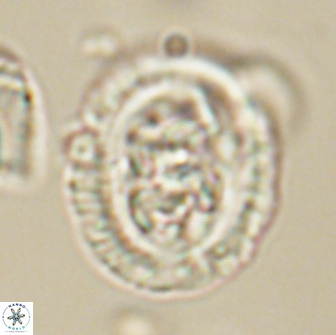 Chiasmolithus edentulus 66880