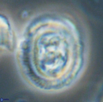 Chiasmolithus edentulus 66882